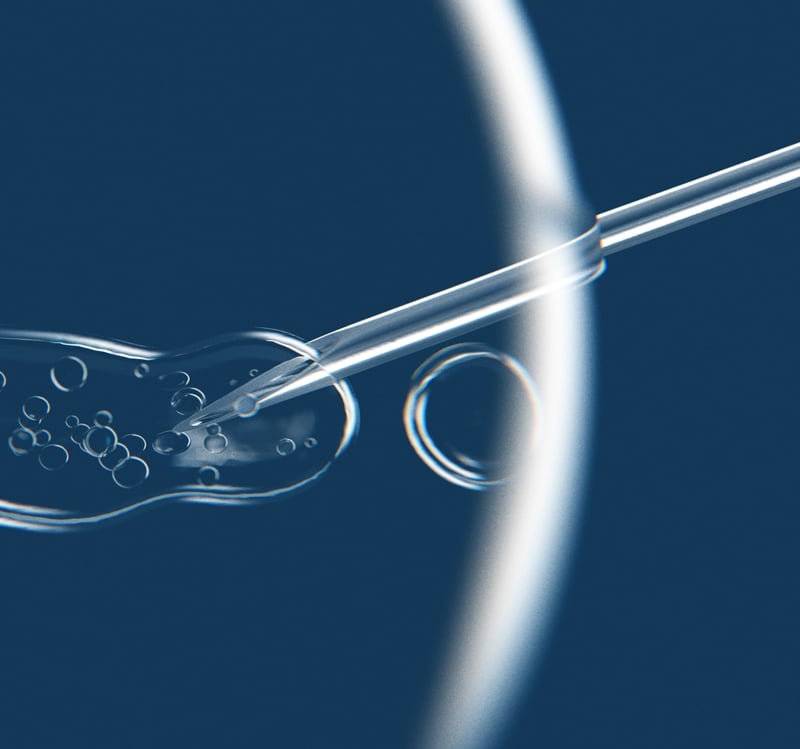 Microinjection